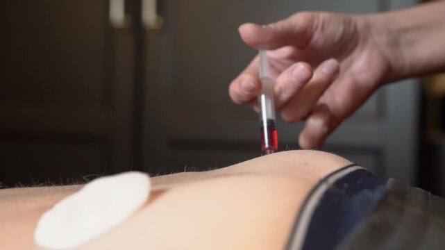 Blood draw procedure with syringe performed in medical office by trained staff