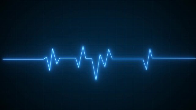 Heart Failure, Life Stopping, Medical Emergency, Health Crisis, Cardiac Arrest, And Critical Care Concepts. Medical Animation of a Green Heartbeat Wave Transitioning Into A Straight Red Flatline. 4K
