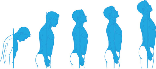 Vector Sequence of Five Human Silhouettes Demonstrating Transition from Slouched Posture to Upright Alignment © Abdur