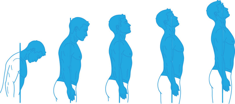 Vector Sequence of Five Human Silhouettes Demonstrating Transition from Slouched Posture to Upright Alignment
