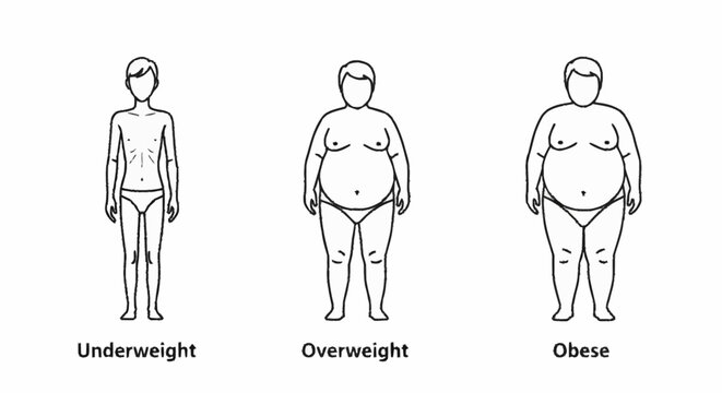 Human Body Types Underweight Overweight Obese.