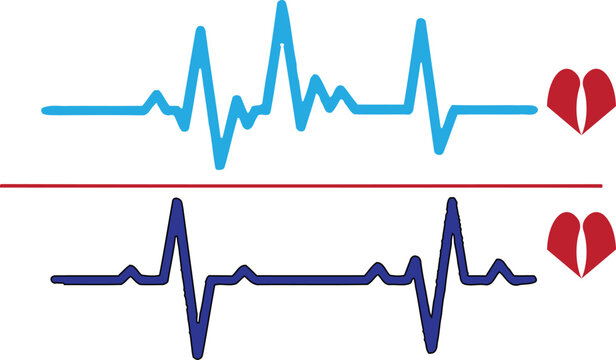 Ecg heartbeat monitor and electrocardiogram rhythm comparison