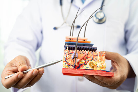 Hair transplant, Asian dermatologist doctor holding skin structure anatomy model for treatment in hospital.