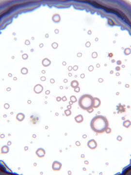 Microscopic view of seminiferous tubule cross section with spermatids and Sertoli cells isolated on a transparent background