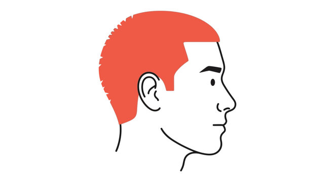 Man Balding Red Hair.