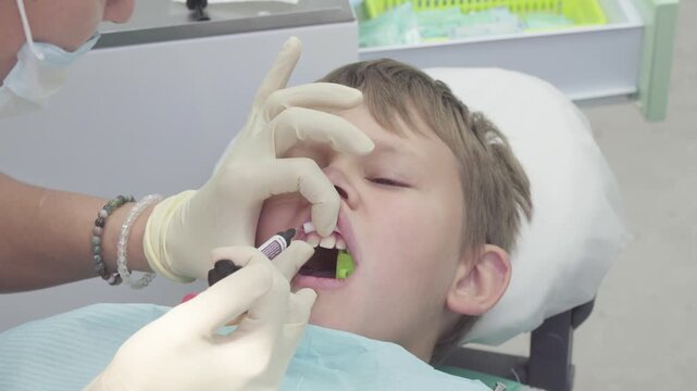 Dentist carefully glues chipped tooth fragment back to a child's tooth in a dental office. The process shows the attention to detail