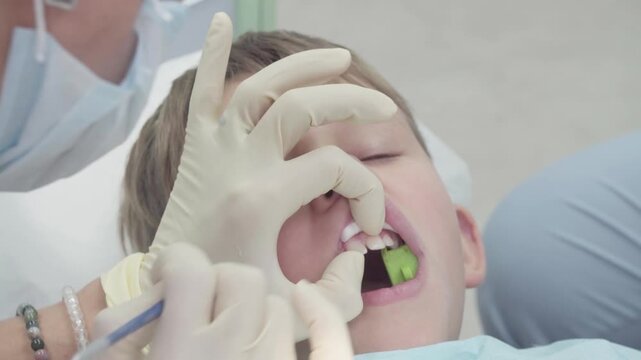 Dentist repairs the boys chipped tooth with glue. Assistant uses ultraviolet light to cure the glue, ensuring a strong bond and quick fix