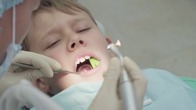 Dentist is polishing a glued fragment of a boys chipped tooth. The procedure is done to restore the tooths appearance and functionality