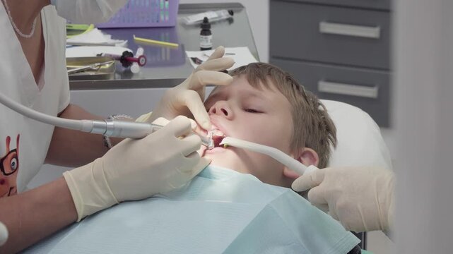 Dentist is polishing a glued fragment of a boys chipped tooth. The procedure is done to restore the tooths appearance and functionality