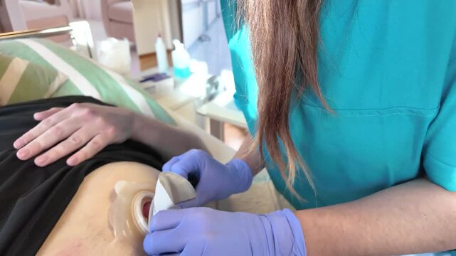 Nursing student attaching ostomy pouch to wafer under supervision using correct technique in stoma care training