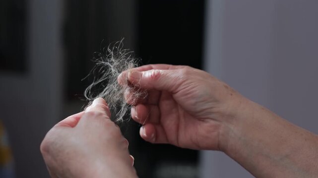 A woman holding her fallen hair, close-up. Alopecia.