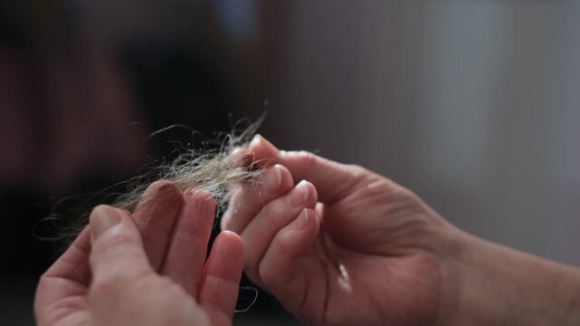 Alopecia. Close-up of a woman's lost hair.