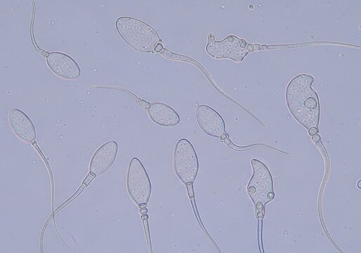 Microscopic view of sperm cells swimming in a fluid medium under a microscope.