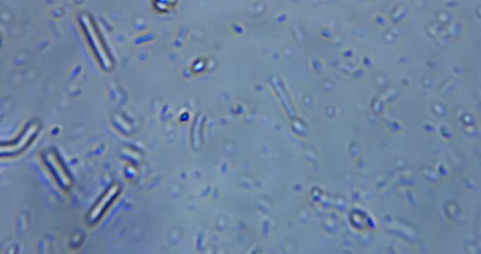 real microscopic footage capturing living microorganisms in natural freshwater. The video shows authentic movement of protozoa, ciliates, rotifers, microalgae, and other aquatic microfauna 