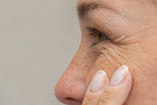 Smiling mature woman touching skin around eye with fingers