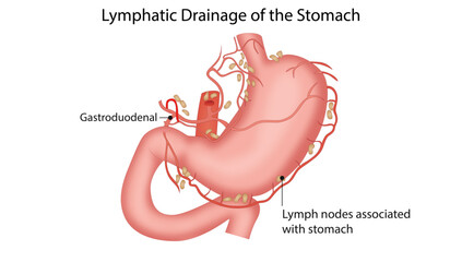 Lymphatic Drainage of the Stomach, the lymphatic vessels and lymph nodes associated with the stomach along the gastric and gastroduodenal regions.