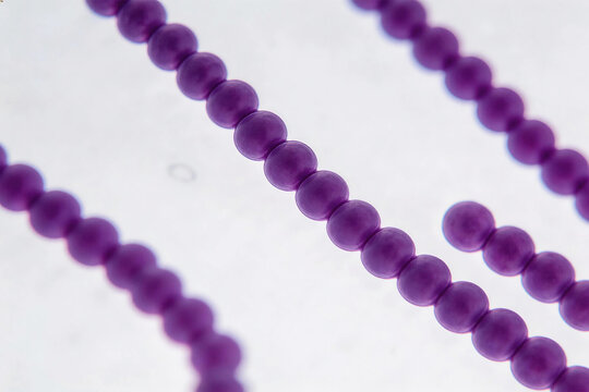 A micrograph of the chain-like structure of Streptococcus pneumoniae, which appears bright purple after Gram staining.