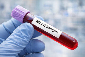 Obraz premium Laboratory Technician Holding Blood Sample Test Tube for Medical Analysis