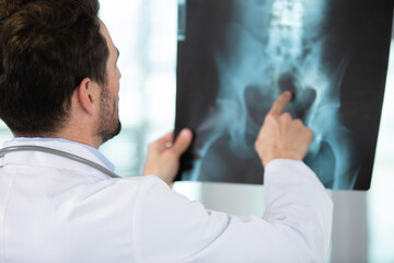 Fototapeta premium male doctor points at pelvic x-ray