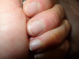 detail of fingers on a hand