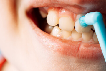 Close up child brushing teeth with a single tuft toothbrush, dental hygiene and oral care.