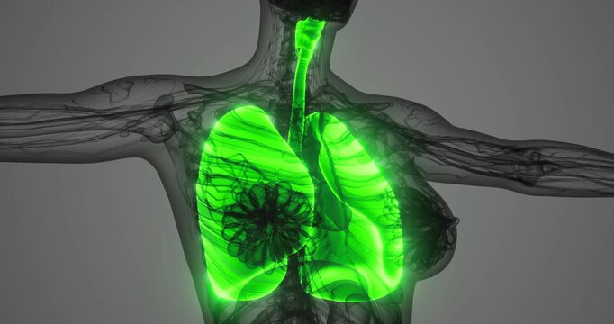 The illustration shows the anatomy of human lungs, clearly depicting the airway system and pulmonary features in green for enhanced visibility, showcasing the respiratory structure and function.