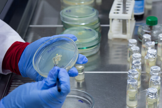 A scientist works with bacteria on a petri dish using a microbiological loop, an experiment with bacteria in a microbiology laboratory.