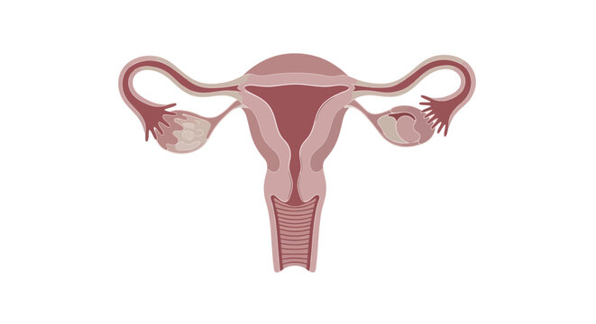 The image depicts a detailed illustration of a female reproductive system including the uterus fallopian tubes and ovaries in a medical context.