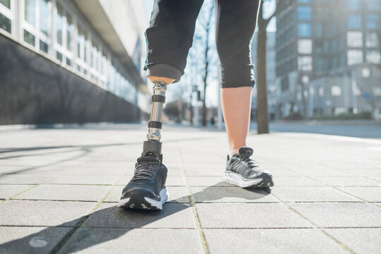 Close-up of legs of sporty woman with leg prosthesis in the city