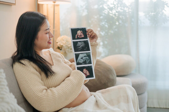 Pregnant woman showing ultrasound film of her baby while sitting on sofa.