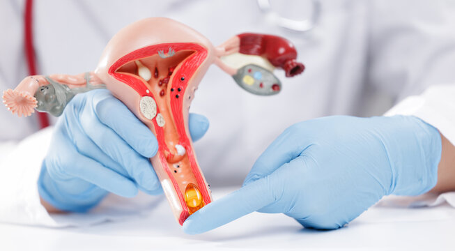 Closeup of gynecologist gloved hands pointing at uterine anatomical model use vitamins and suppositories to restore microflora for reproductive health