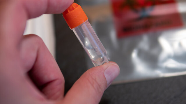 Hand holding DNA saliva sample collection tube from home genetic ancestry testing kit. Concept of personal DNA analysis, genetic testing, biotechnology and laboratory diagnostics.