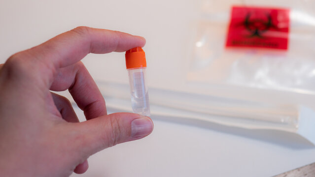 Hand holding DNA saliva sample collection tube from home genetic ancestry testing kit. Concept of personal DNA analysis, genetic testing, biotechnology and laboratory diagnostics.