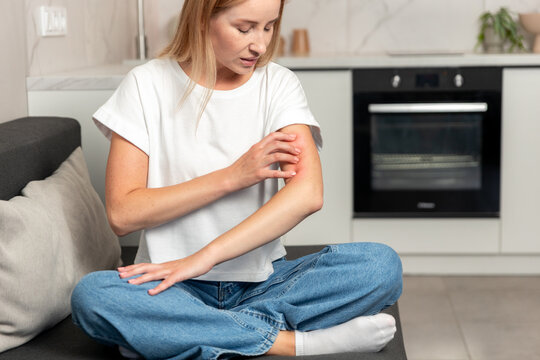 Woman with rash on her arm experiences irritation in her home