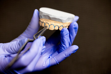 Close up of orthodontic bracket positioned on upper jaw plaster model using reverse tweezers emphasizing precise placement ligature procedure and professional dental workflow for braces treatment © Anton