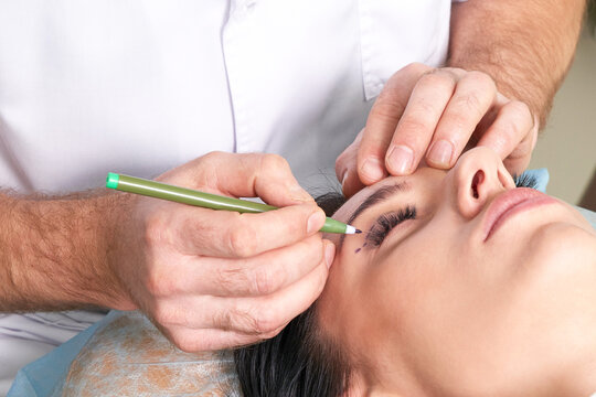  plastic surgeon and young woman with correction lines before cosmetic surgery, drawing lines on eyes