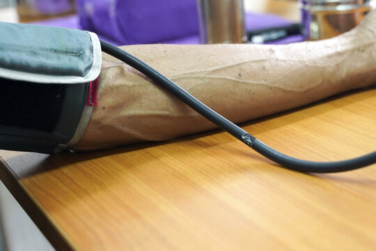 Automated blood pressure monitor in use during a routine medical health checkup at a clinic.