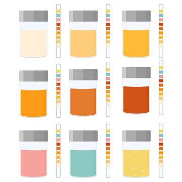 Urinal test kit set of urine sample cup and urinalysis reagent strips for kidney exam, urinary tract infection and cystitis diagnostics. Medical vector illustration.