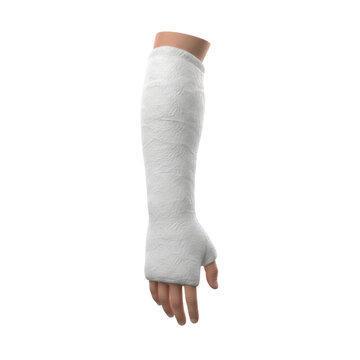 White plaster arm cast on human hand and forearm isolated