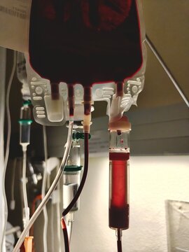 Transfusi&oacute;n de sangre en hospital por donaci&oacute;n de pacientes donantes