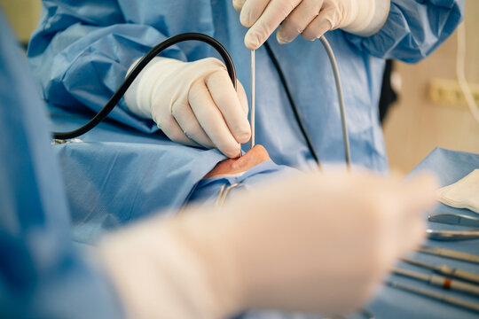 Medical professionals perform a detailed endoscopic procedure on a patient's nose, utilizing specialized instruments and gloves in a sterile operating room environment