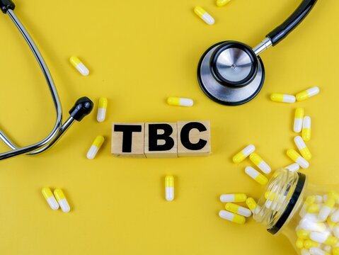 Concept word TBC on wooden blocks isolated - on yellow background 