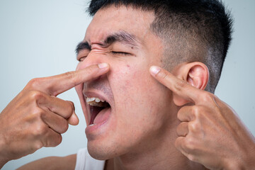 Obraz premium Young Asian man in a white tank top points at facial acne on both cheeks against a light gray background, showing skin concern, blemish inspection, and personal skincare awareness