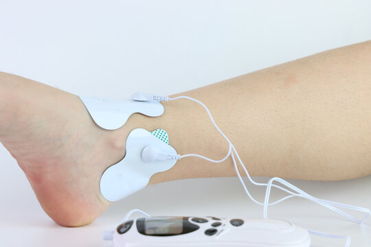 A person's foot and ankle are shown with TENS unit electrode pads attached for pain relief therapy