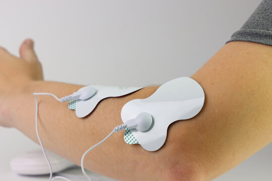 Electrodes attached to arm for TENS therapy, promoting muscle relaxation and pain relief