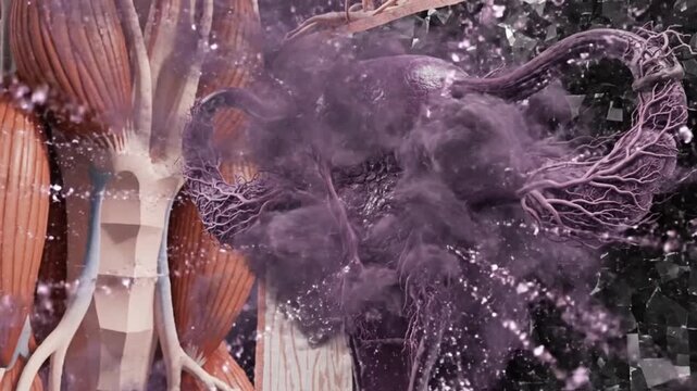 Advanced FemTech Concept of Uterine Disease Progression and Inflammation Showing Adenomyosis Pathology for Healthcare Campaigns