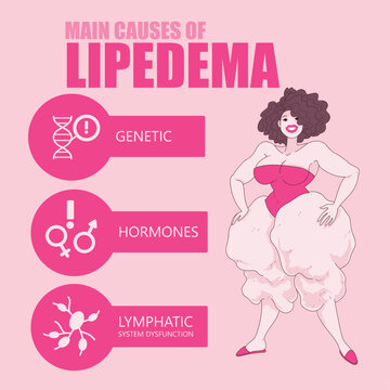 Women's disease. Main causes of lipedema. Healthcare infographic. Medical infographic. Vector illustration. 