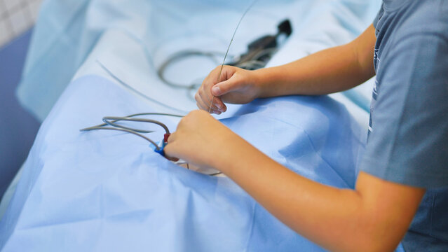 Surgeon hands holding medical guidewire during minimally invasive procedure