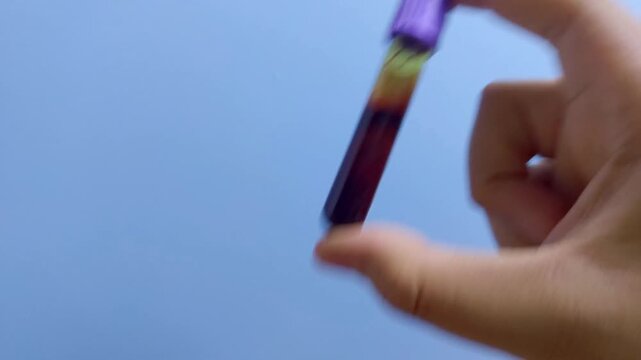 Conceptual visualization of rare disease a hand holds a blood sample in a test tube, representing the intricate scientific investigation and diagnostic challenges