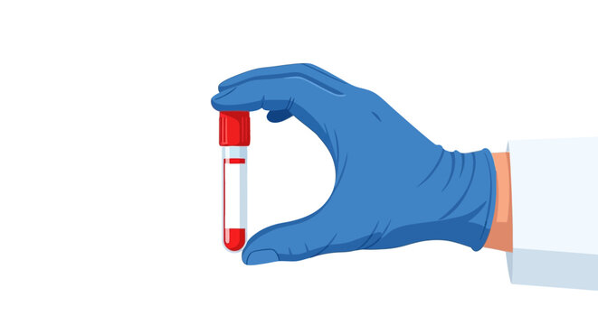 Gloved hand holding a blood sample tube against a white background